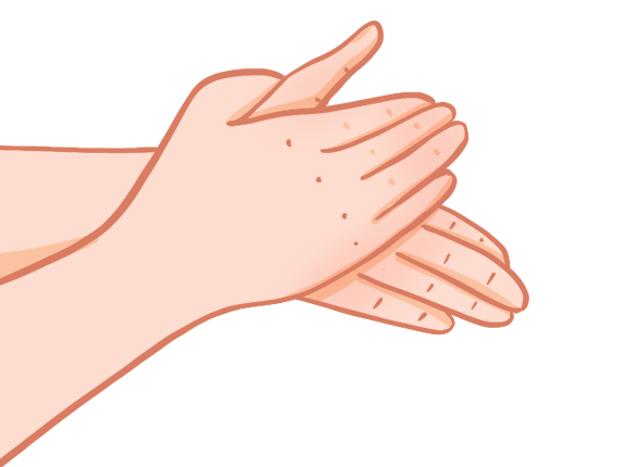 免洗洗手液的好處和壞處，使用時要注意什么，用了粘手咋回事